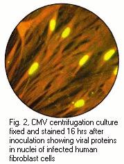 DEAFF (Detection of Early Antigen Fluorescent Foci) test za CMV Cytomegalovirus (CMV) - serologija Anti-CMV IgM Pojava 3-4 dana nakon infekcije Pad nakon nekoliko tjedana i dalje sporo kroz 4-6