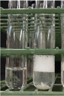 diagnóstico bacteriológico