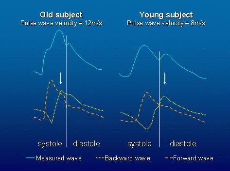 Κεντρικι αρτθριακι πίεςθ Central blood pressure is composed by two waves.