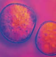 Celule stem isolate Fidia Advanced Biopolymers Celule umane canceroase imagine obtinuta cu Microscop cu fluorescenta; G. M. J. Segers-Nolten, V.