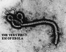 Ebola Povzroča hemoragično