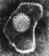 simplex (HSV), citomegalovirus (CMV),