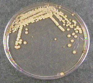 Izgled bakterijske populacije
