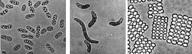 Škrlatne žveplove bakterije Chromatium vinosum
