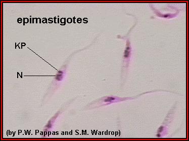 Trypanosoma - spalna bolezen Klinična slika: lokalno vnetje, razjede glavoboli