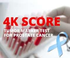 AS και βιοδείκτες/γονιδιακές δοκιμασίες Βιοδείκτες : ορού: Prostate Health Index (phi), 4K score