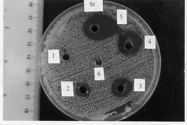 ٢٩ E.coli.