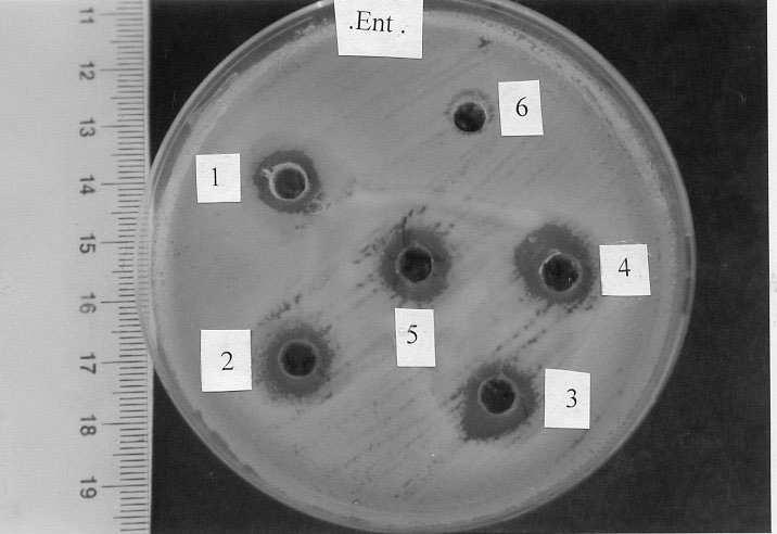 ٢٩ Klebsiella.spp.