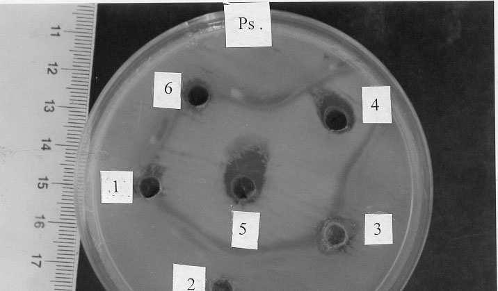 بكتريا St.= Staph.aureus % ٢-١ K. = Klebsiella.