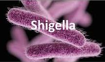 Σε πρόσφατες μελέτες η Shigella είναι η πιο συχνή εργαστηριακή λοίμωξη Ellen Jo Baron, J.