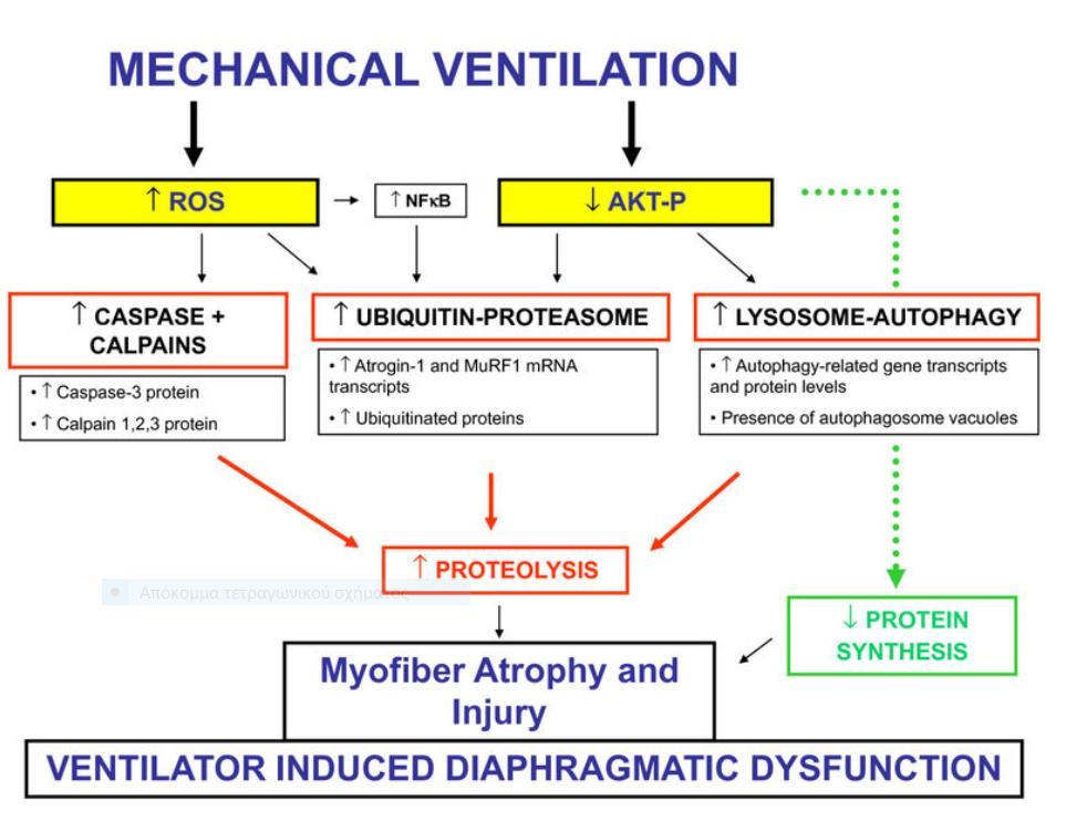 Ventilator Induced Diaphragmatic Dysfunction (VIDD) Μυϊκή Ατροφία εξ αχρησίας