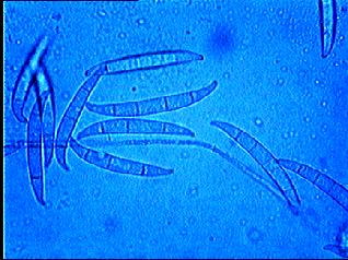 Rod Fusarium Bela gljiva na