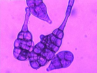 Rod Alternaria Crna, mrka