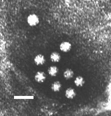 Virusi - agensi akutnog gastroenteritisa Sluĉaj