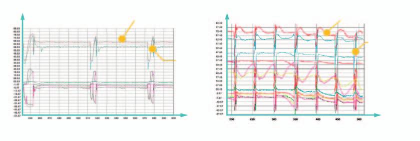 SDV4 individualni inteligentni defrost poboljšava kapacitet grijanja Test crtež: inteligentni defrost Grijanje 85 min Defrost 4 min Test crtež: