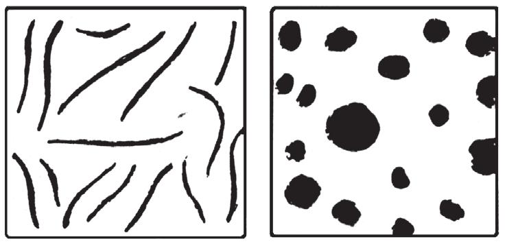 6 Forme caracteristice ale grafitului în fontele cenuºii turnate: a) grafit lamelar; b) grafit nodular. a b c Fig.
