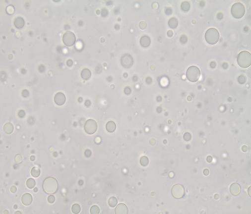 7. ΑΠΟΤΕΛΕΣΜΑΤΑ - ΣΥΖΗΤΗΣΗ Εικόνα 7: Απεικόνιση λιποσφαιρίων 150w 2m 0d Εικόνα 8: Απεικόνιση λιποσφαιρίων