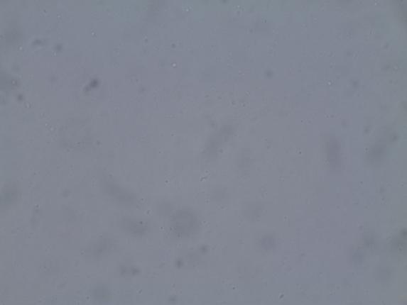 Απεικόνιση λιποσφαιρίων Τ 1 0d Εικόνα
