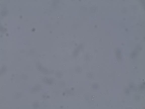 Εικόνα 25: Απεικόνιση λιποσφαιρίων 150w