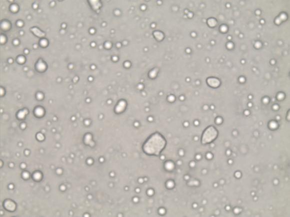 λιποσφαιρίων 550w 2m 2d Εικόνα 34: Απεικόνιση λιποσφαιρίων 750w 2m 2d Από