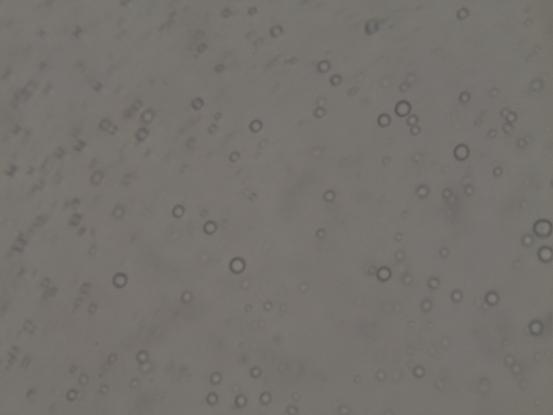 7. ΑΠΟΤΕΛΕΣΜΑΤΑ - ΣΥΖΗΤΗΣΗ Εικόνα 48: Απεικόνιση λιποσφαιρίων 150w 10m 4d Εικόνα 49: