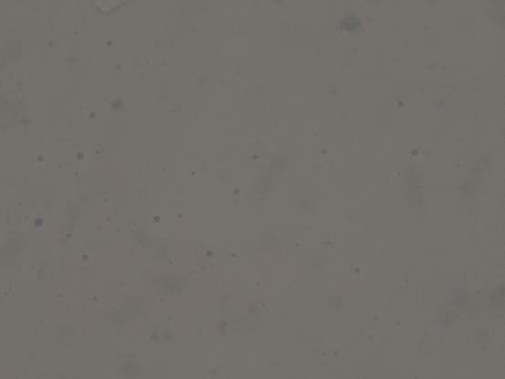 Απεικόνιση λιποσφαιρίων 750w 10m 4d Από την εικόνα 47 παρατηρείται συσσωμάτωση των