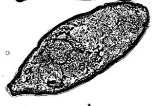 b c d a e f Obr. 91. a dospelé jedince Schistosoma spp., b vajíčko S. mansoni, c miracídium, d sporocysta, e furkocerkária, f schistosomulum (upravené podľa Mehlhorna, 2008) Vývinový cyklus (Obr.