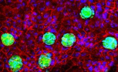 Trafficking Protein Structure INFECTIONS &