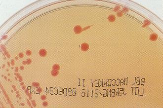 ΑCINETOBACTER