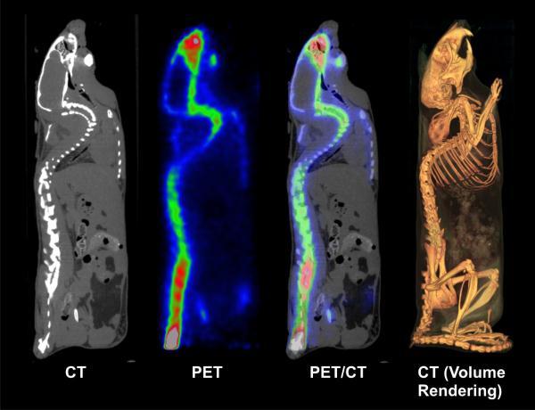 PET/CT PET/CT je vodeći uređaj u slikovnoj i funkcionalnoj dijagnostici u medicini, kombinacijom PET-a (pozitronske emisijske tomografije), koji pokazuje intenzitet metabolizma glukoze u ćelijama, te