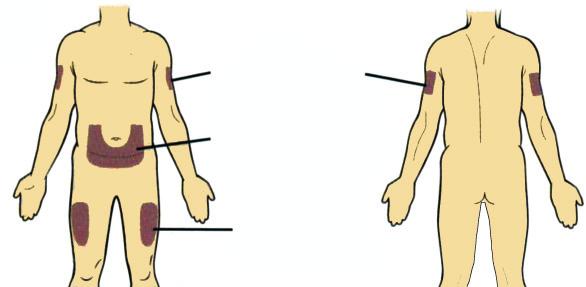 Fəsil 7. Dializ xəstələrin problemləri Áàçóíóí áàéûð ñÿòùè Ãàðûíûí þí äèâàðû Áóäóí þí ñÿòùè Şəkil 7.2.
