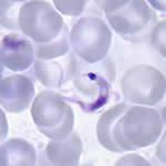 AMERIKA ERDIKO GAIXOTASUN INFEKZIOSO INPORTATUAK CHAGAS GAIXOTASUNA Trypanosoma cruzi-k eragindako eritasuna Tximitx (chinche) batek azala ziztatu -