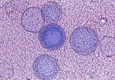 eragileak: Coccidioides immitis eta Paracoccidioides