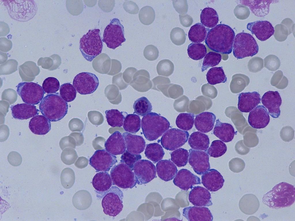 Αιτιολογία; Stem cell Μοριακά