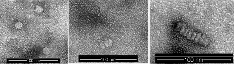 3.5. Nanodiskoen tamaina eta itxura Transmisiozko Mikroskopio Elektronikoaz HDL nanopartikulen egitura zuzenean behatu ahal izateko uranil azetatoaren bidezko tindaketa negatiboa burutu eta TMEaren
