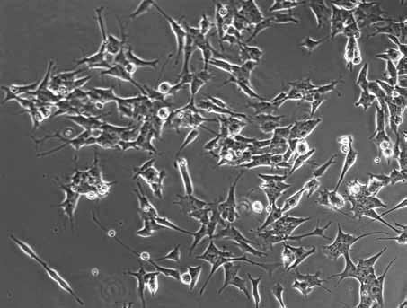Organska bioelektronika Živčne celice (shy5y) v laboratorijski kulturi (Vir: people.qc. cuny.