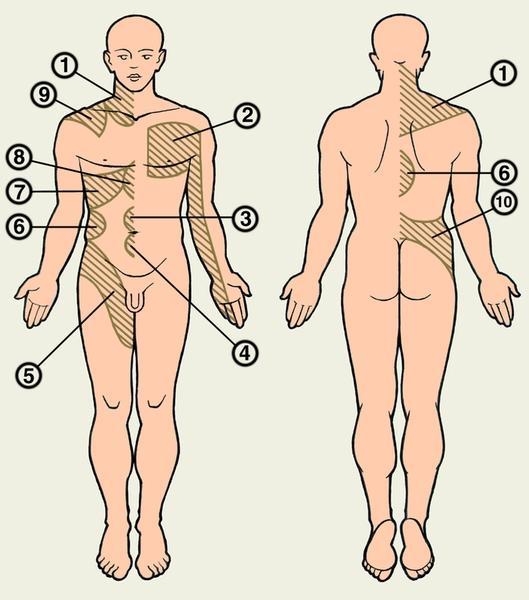Zonele în care pot apărea dureri și hiperestezie în maladiile plămânilor și bronhiilor (1), ale cordului (2), intestinului (3),