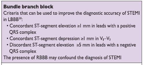 LΒΒΒ: Δυσκολία στο ΗΚΓ, όχι αδυναμία διάγνωσης σε ST ανωμαλίες Νέος ή πιθανότα τα νέος LBBB Γνωστόςπροϋπάρχω