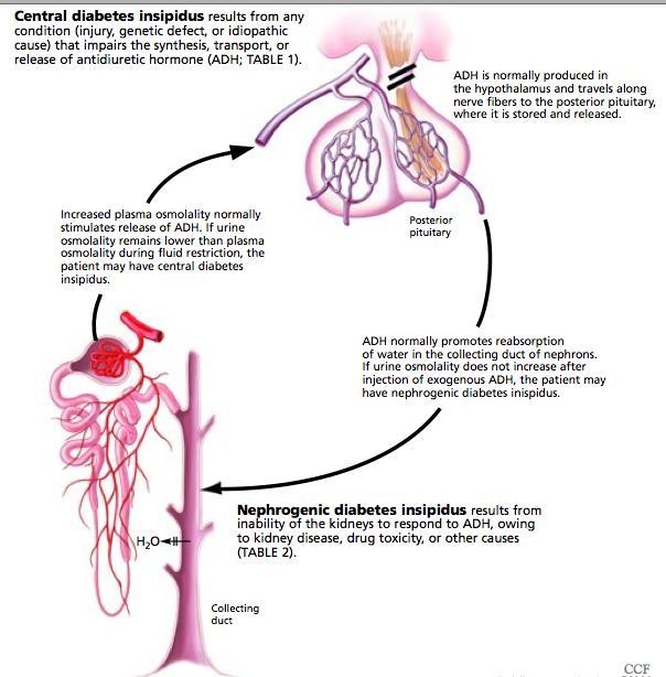 Cea mai frecventă cauză de hipernatremie relativă prin pierdere de apă este diabetul insipid (incapacitatea rinichilor de a concentra urina, cu poliurie hipotonă).