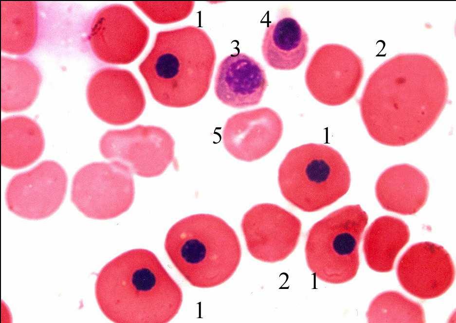 Bojenja preparata krvi Krv embriona pacova starosti 16 dana, acidofilni megaloblasti prve generacije (1) i sazreli megalociti (2) hiperhromne citoplazme, pojava polihromatofilnih (3) i acidofilnih
