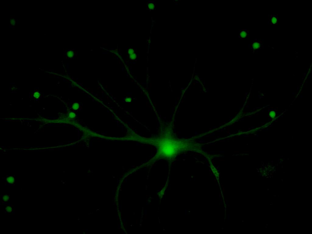 Rolul astrocitelor în metabolismul cerebral Astrocitele perivasculare: rol în fluxul de substrat energetic către neuroni Astrocitele perisinaptice: tampon