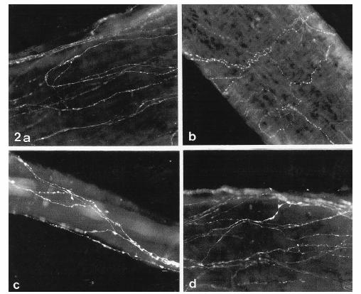 Nervi perivasculari ai arterelor cerebrale la om.
