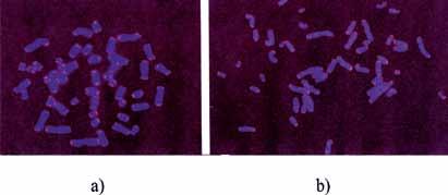 IV. DNR BIOSINTEZĖ (REPLIKACIJA) 4.53 pav. Žmogaus fibroblastų telomerų trumpėjimas ląstelėms senstant. Ląstelių, pasidalijusių 16 kartų, chromosomų vaizdas, gautas FISH (angl.