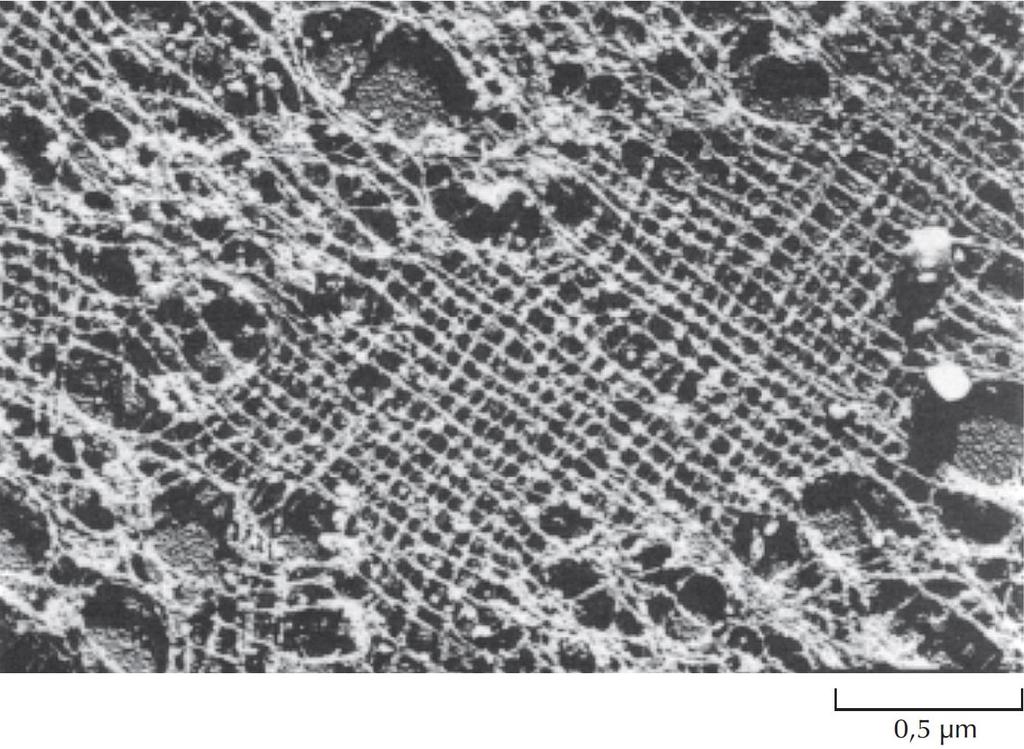 ΕΙΚΟΝΑ 9.3 Φωτογραφία ηλεκτρονικού μικροσκοπίου που δείχνει την πυρηνική λάμινα.