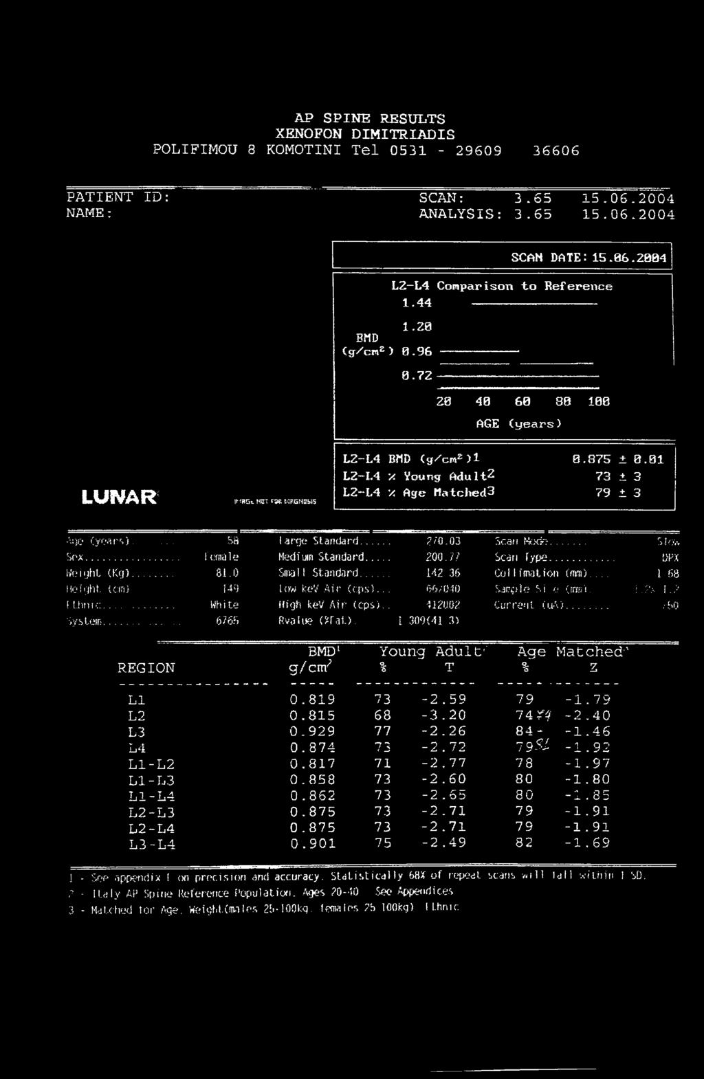 .. Height (Kg)... Height, (an)! l.hn i c... System... 58 female 81.0 149 Wh i te 676S large Standard... Medium Standard... Snail Standard... low kev Air (cps)... High kev' Air (cps).