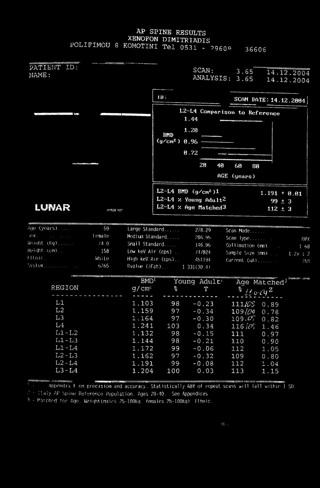 .. 59 Large Standard... 278.29 Scan Mode.. νγ Χ... (ema1c Medina Standard 706.% Scan lype....... l)px Weight. (Kg)...?4.0 Small Standard... 146.96 Coli illation (inn)..,. i 68 Height (cm).