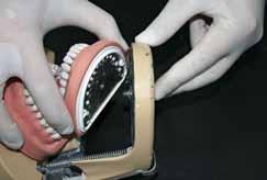 Εισαγωγή Β) Οι οδοντικοί φραγμοί