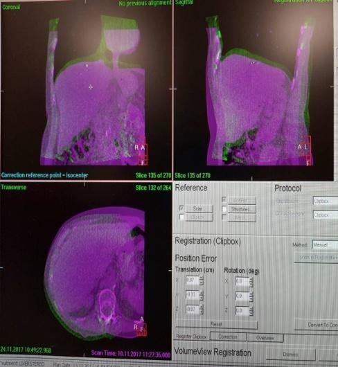 CBCT ΜΕ