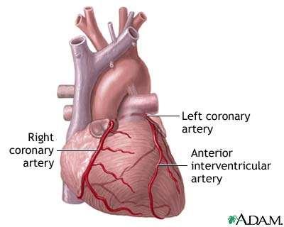 Στη χρόνια καρδιακή ανεπάρκεια η καρδιά διογκώνεται και χάνει την ικανότητά της να αντλεί επαρκείς ποσότητες αίματος.