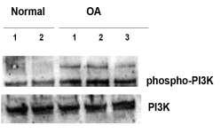 Εικόνα 44: Πρωτεϊνική έκφραση των phospho PI3K (αριστερά) και phospho Akt (δεξιά) σε ΟΑ και φυσιολογικά χονδροκύτταρα.